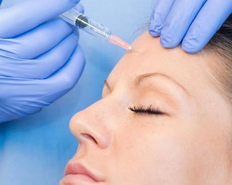 Toxina Botulínica (Botox)